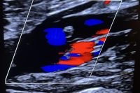 Thrombone Shorty