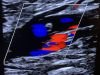 Thrombone Shorty