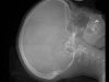 Rat Skull
